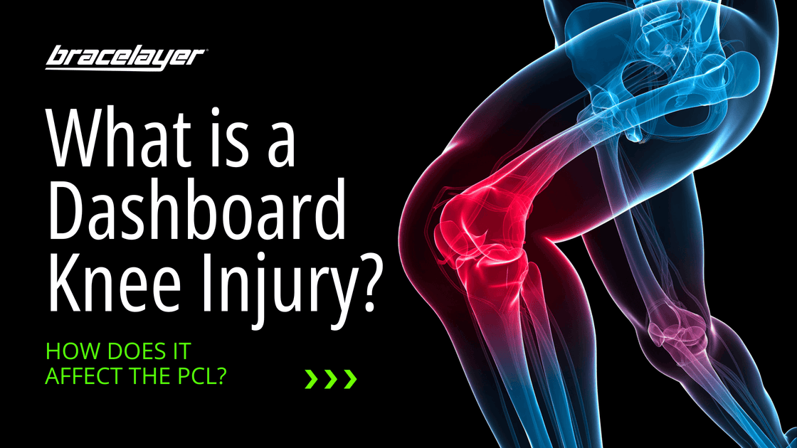 What is a Dashboard Knee Injury? How Does It Affect the PCL?